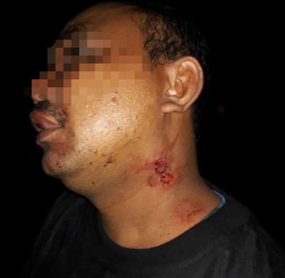 Kapolsek Randublatung: Tidak Ada Anggota TNI Terlibat Dugaan Penganiayaan