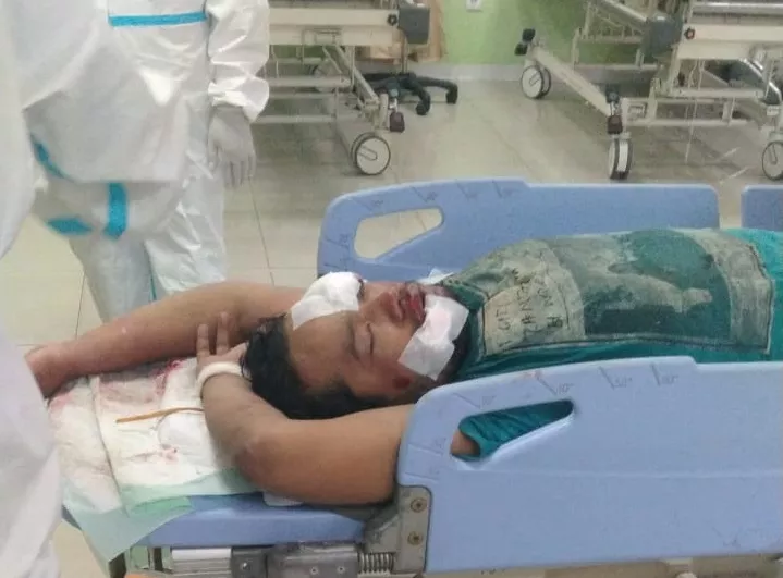 Jambret saat Transisi New Normal, Bandit Jalanan Nyaris Tewas Dimassa