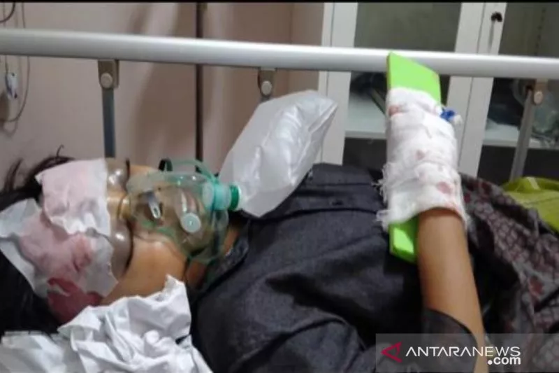 Santri di Pamekasan Dianiaya hingga Gegar Otak